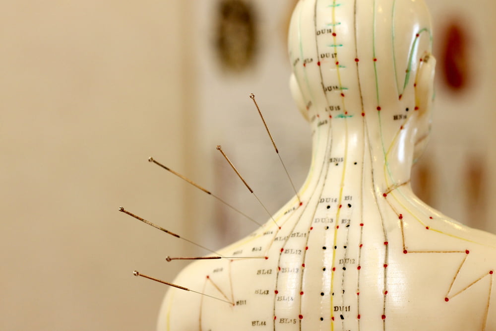 How Acupuncture Can Release Natural Painkillers