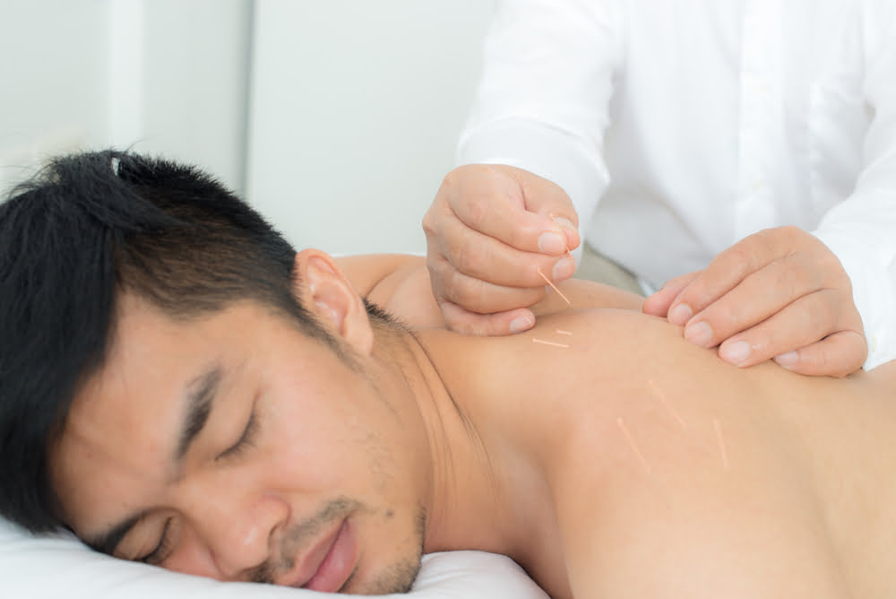 How Acupuncture Promotes Healing Blood Flow