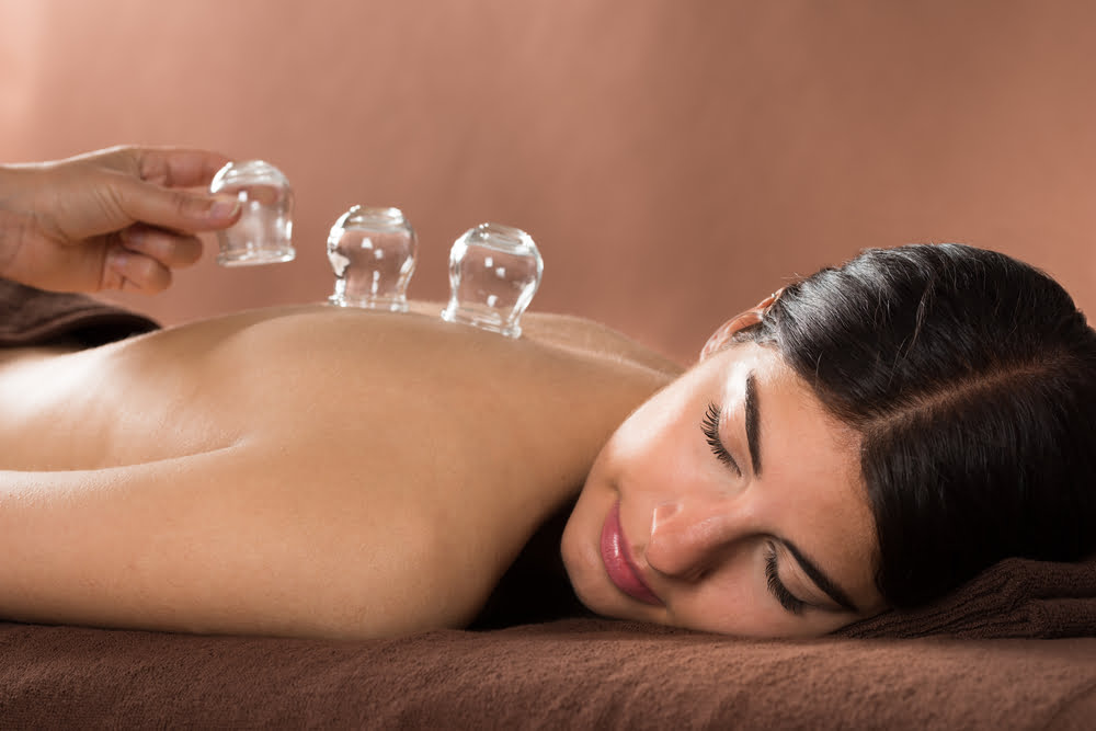 Ancient History of Cupping Therapy