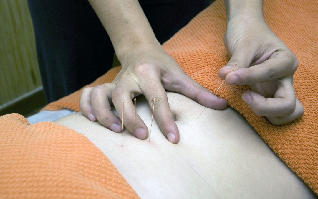 What Makes Acupuncture an Effective Pain Reliever?