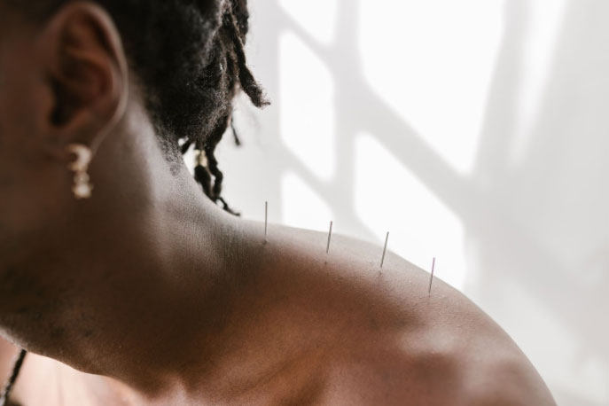 How Does Acupuncture Heal My Body?