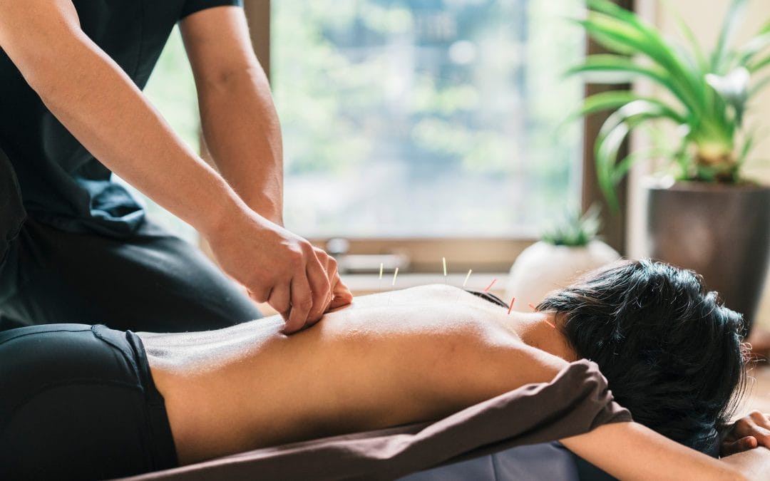 Needle Nervous? Here’s What Really Happens During an Acupuncture Session