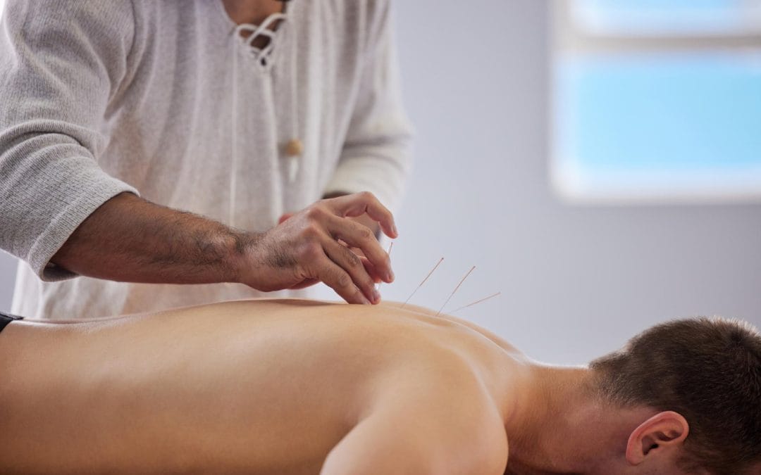 Feeling Worn Out? Here’s How Acupuncture Can Recharge Your Body Naturally